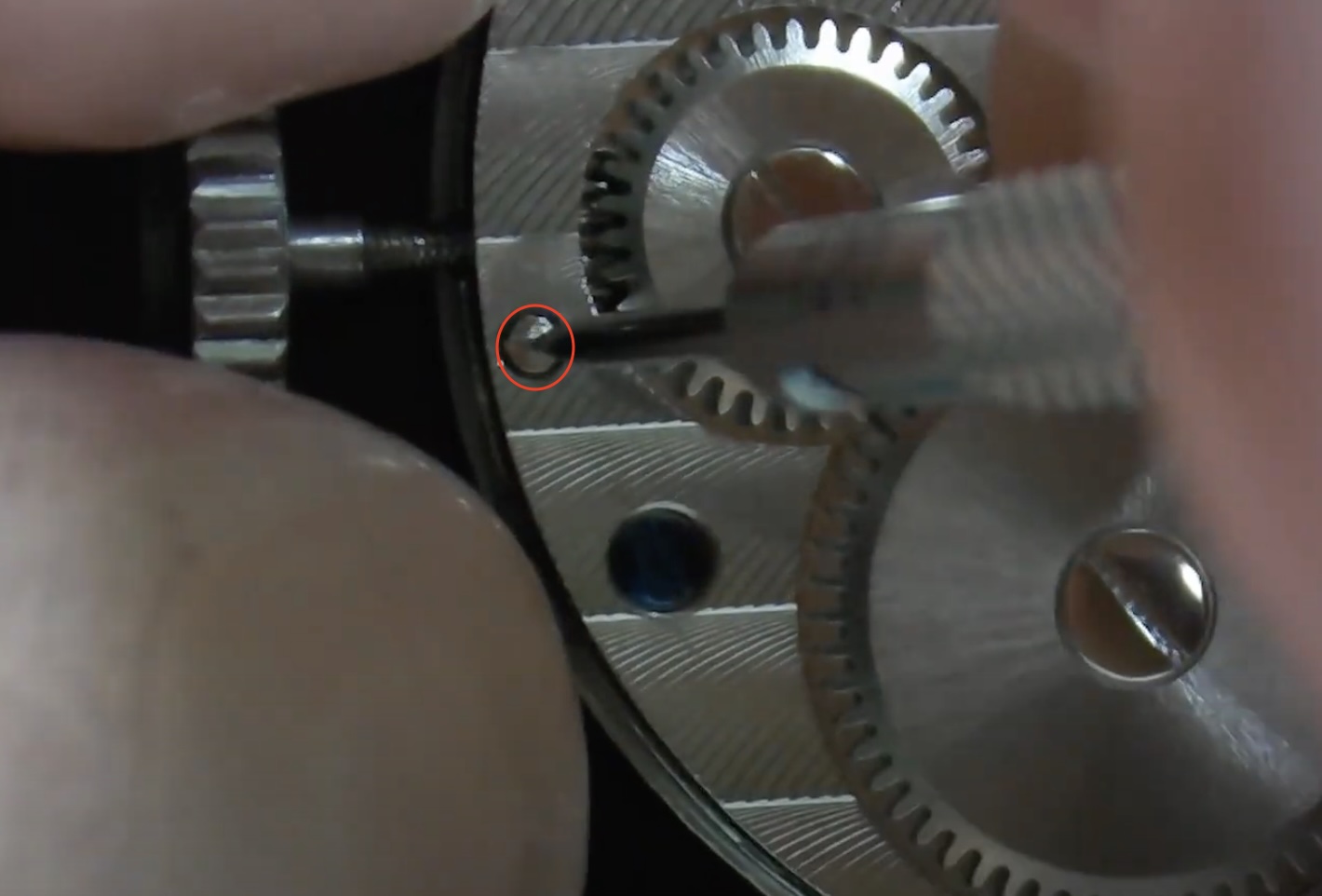 Retrait de la couronne